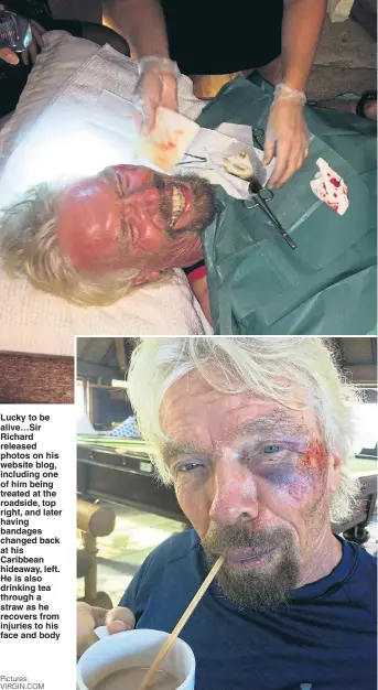  ?? Pictures: VIRGIN.COM ?? Lucky to be alive…Sir Richard released photos on his website blog, including one of him being treated at the roadside, top right, and later having bandages changed back at his Caribbean hideaway, left. He is also drinking tea through a straw as he...