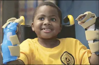  ?? AFP ?? An undated photo shows Zion Harvey posing with his newly transplant­ed hands.