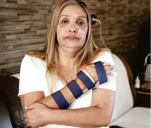  ?? Rivaldo Gomes/folhapress ?? Maria Solange aposentou-se por invalidez após fazer uma cirurgia na mão; ela está questionan­do a demora do estado em corrigir o valor do seu benefício