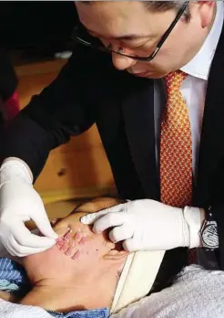  ??  ?? Dr Kwon Han Jin showing that no incisions or stitches are required for the Ultra V Lift treatment.