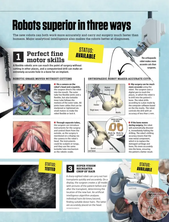  ??  ?? The orthopaedi­c robot makes more accurate cuts than surgeons.