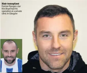  ??  ?? Hair transplant Former Rangers star Kris Boyd had his operation at a private clinic in Glasgow