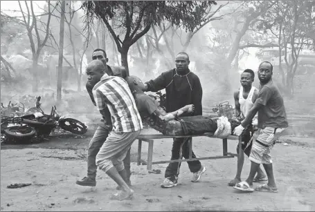  ?? ASSOCIATED PRESS ?? An injured man is carried from the scene as a fuel tanker burns in the background on Saturday in Morogoro, Tanzania. A damaged tanker truck exploded in eastern Tanzania on Saturday as people were trying to siphon fuel out of it, killing 69, in one of the worst incidents of its kind in the East African country.