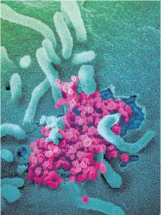  ?? FOTO: NATIONAL INSTITUTES OF HEALTH/AFP ?? Das Virus (in Magenta) unter dem Mikroskop.