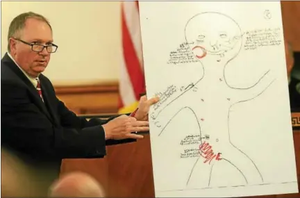  ?? PHOTOS BY TANIA BARRICKLO — DAILY FREEMAN ?? In his closing statement to the jury Thursday, Ulster County District Attorney Holley Carnright uses a drawing to illustrate bruises found on the body of 2-year-old Mason DeCosmo.