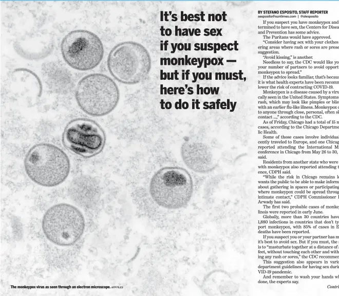  ?? AFP FILES ?? The monkeypox virus as seen through an electron microscope.