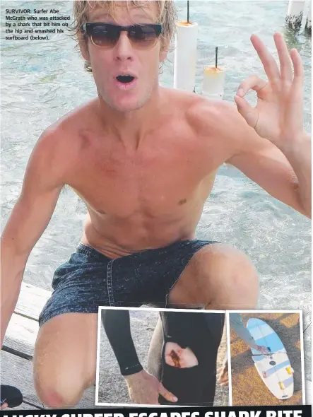  ?? SURVIVOR: Surfer Abe McGrath who was attacked by a shark that bit him on the hip and smashed his surfboard ( below). ??