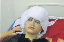  ?? WASEEM ANDRABI/HT ?? Iqra Sidiq, who sustained a skull fracture during a protest, undergoing treatment in Srinagar on Tuesday.
