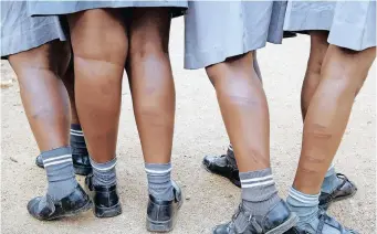  ?? ZANELE ZULU African News agency (ANA) ?? LEARNERS show the mark of cane on their legs, the victims of corporal punishment.
|