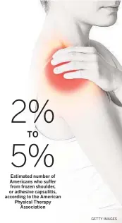  ?? ?? Estimated number of Americans who suffer from frozen shoulder, or adhesive capsulitis, according to the American Physical Therapy Associatio­n