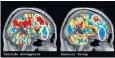  ??  ?? Scan shows the difference in brain activity