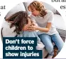  ?? ?? Don’t force children to show injuries