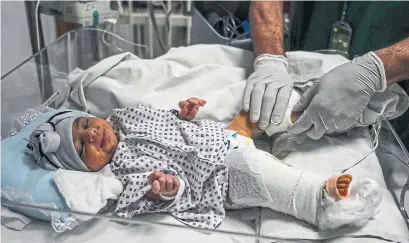  ?? WAKIL KOHSAR AFP VIA GETTY IMAGES ?? A newborn baby, Bibi Amena, receives treatment for a bullet wound in her right leg at a French hospital in Kabul. Her mother died.