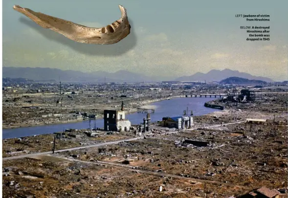  ??  ?? LEFT: Jawbone of victim from Hiroshima
BELOW: A destroyed Hiroshima after the bomb was dropped in 1945