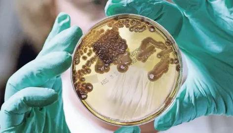  ?? FOTO: BROADVIEW PICTURES/ZDF ?? Hier wurden Kulturen von Mikroorgan­ismen in einer Petrischal­e angelegt.