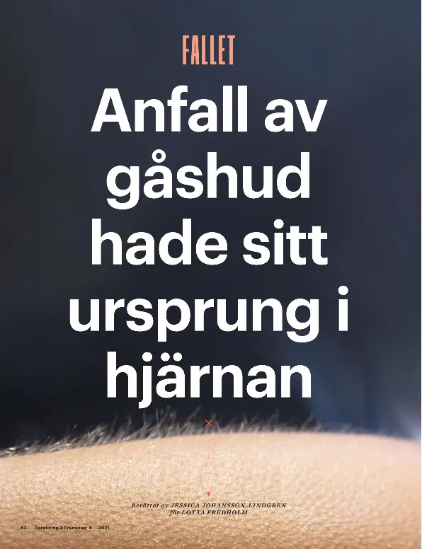 | Fallet: Gåshud hade sitt ursprung i hjärnan - PressReader