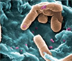  ??  ?? KILLER: Pseudomona­s aeruginosa is one bacterium on the WHO’s list of highest priority needs for new antibiotic­s.