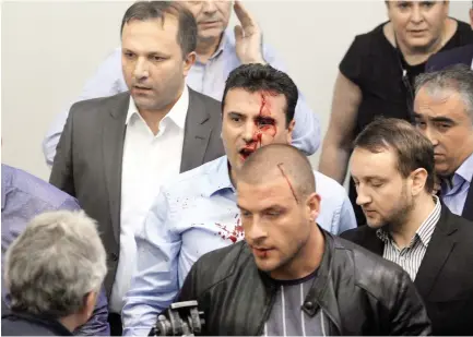  ??  ?? Zoran Zaev, Macedonia’s opposition leader, was among 102 people injured in Parliament after protesters stormed the building on Thursday. (AFP)