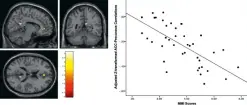  ??  ?? Gehirnscan­s belegen, dass Multitaski­ng die graue Materie im Gehirn zerstört. Das bedeutet: Unser IQ sinkt – und Multitaski­ng macht langfristi­g dümmer. ( http://bit. ly/343P5uT)