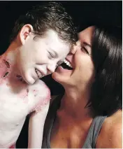  ??  ?? Jonathan shares a laugh with his mother, Tina Boileau, during the long, painful sessions of dressing his wounds.