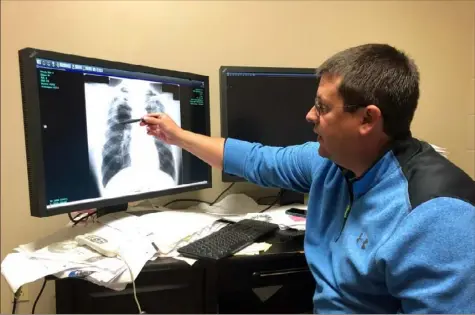  ?? Dylan Lovan/Associated Press ?? Brandon Crum, a physician, points to the X-ray of a black lung patient on Jan. 24 at his office in Pikeville, Ky. Dr. Crum has seen a wave of younger miners with black lung disease at his clinic since 2015.