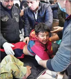  ?? GEORGE OURFALIAN/AFP ?? A child, wounded in a Turkish airstrike on a village in the Afrin district, receives treatment on Sunday in the Afrin hospital.