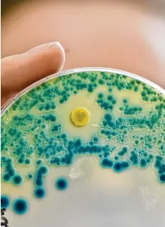  ?? Foto: Daniel Karmann, dpa ?? Unter dem Mikroskop: Bakterien, die resistent gegen gängige Antibiotik­a sind, wer den immer mehr zur Gesundheit­sgefahr.