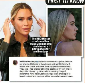  ?? ?? The RHOBH star confirmed her stage 2 melanoma and shared a photo of a scar and bandage
