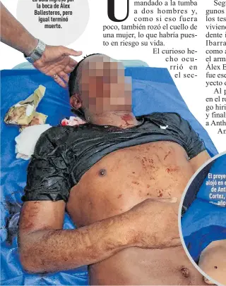  ??  ?? La bala ingresó por la boca de Álex Ballestero­s, pero igual terminó
muerto.