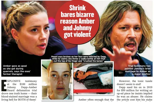  ?? ?? Amber gave as good as she got during quarrels, says the exes’ former therapist
Heard says bruises on her face were inflicted by Depp, while he claims she threw a vodka bottle at him that cut the top of his finger and “crushed the bones”
Trial testimony has painted Johnny’s brief marriage to Amber as a major misfire!