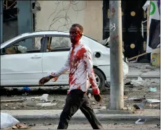  ?? AP Photo/FARAh AbdI WARSAmeh ?? An injured civilian walks away from the scene after being wounded in a bomb blast near the Sahafi hotel in the capital Mogadishu, Somalia, on Friday.