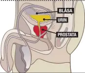  ??  ?? BLÅSA URIN
PROSTATA