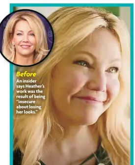  ?? ?? Before An insider says Heather’s work was the result of being “insecure about losing her looks.”