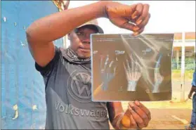  ?? Photo: Kim Harrisberg/thomson Reuters Foundation ?? Hidden damages: A driver shows x-rays from an accident he was in while driving for Uber.