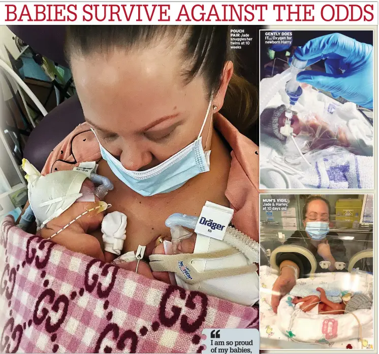  ?? ?? POUCH PAIR Jade snuggleshe­r twins at 10 weeks
GENTLY DOES IT... Oxygen for newborn Harry
MUM’S VIGIL Jade & Harley, at 10 days old