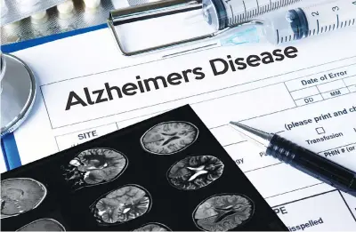  ?? (Dreamstime/tns) ?? Nearly 12% of Texas seniors in 2020 were living with Alzheimer’s disease.