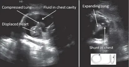  ?? SCANS: DR ISMAIL BHORAT ?? BEFORE AND AFTER: The pre and post-operation ultrasound scans.