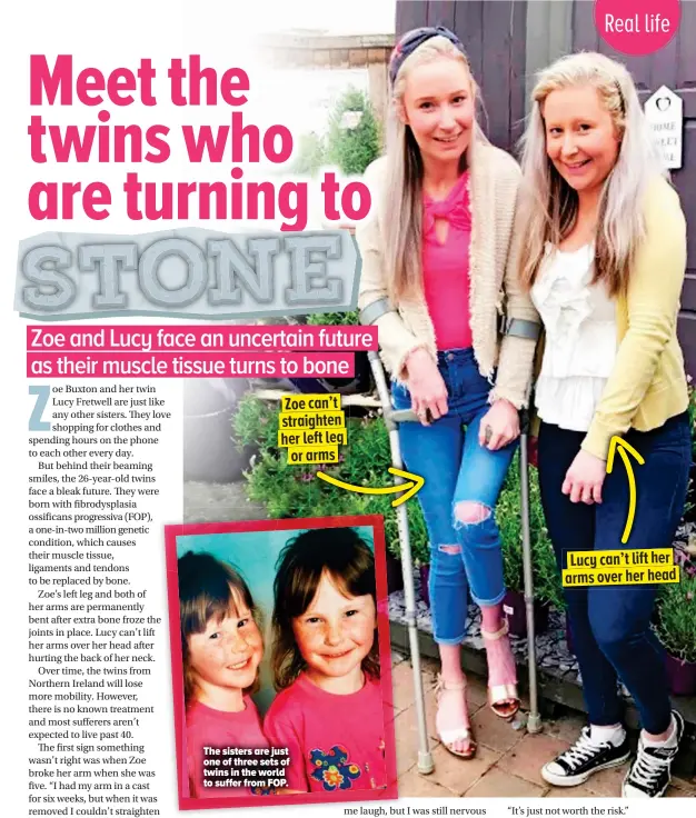 ??  ?? The sisters are just one of three sets of twins in the world to suffer from FOP. Lucy can’t lift her arms over her head