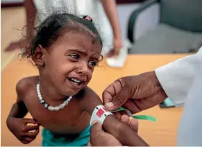  ?? AP ?? A doctor measures the arm of malnourish­ed girl at the Aslam Health Centre, Hajjah, Yemen. 70 per cent of the population is hungry according to a UN report.