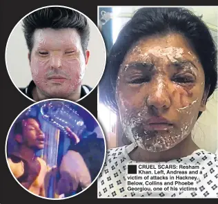  ??  ?? CRUEL SCARS: Resham Khan. Left, Andreas and a victim of attacks in Hackney. Below, Collins and Phoebe Georgiou, one of his victims