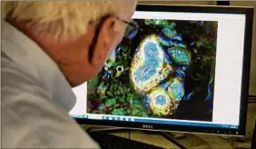  ?? Paul Buckowski / Times Union ?? Frank Rice, president and CEO of Integrated Tissue Dynamics, uses a fluorescen­t microscope Tuesday to look at a skin sample, specifical­ly the blood vessels with the nerve fibers around them, at the lab in Rensselaer. The company is looking at skin samples from patients dealing with long COVID. In patients dealing with fibromyalg­ia, there is an excessive amount of nerve fibers around the blood vessels. Rice believes that he will see the same thing in patients dealing with long COVID.