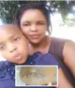  ??  ?? Mrs Sibusisiwe Masuku with her daughter Thabisile Masuku. Inset: The cracked skull