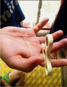  ??  ?? Painfulord­eal: Mohd Alfath showing his finger that was stuck in the fidget spinner.