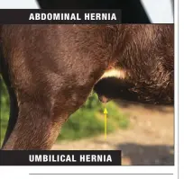  ??  ?? UMBILICAL HERNIA