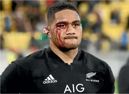  ?? GETTY IMAGES ?? Ofa Tu’ungafasi’s bloodied face and grim expression says it all as the All Blacks ponder their shock loss.