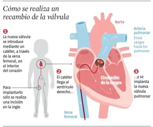  ?? LA VANGUARDIA ?? FUENTE: Vall d’Hebron