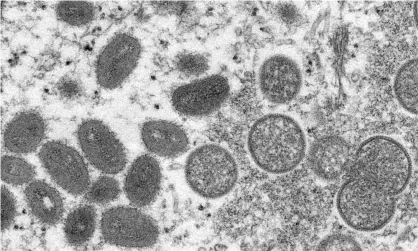  ?? ?? Mature, oval-shaped monkeypox virions, left, and spherical immature virions, right, obtained from a sample of human skin. Photograph: AP