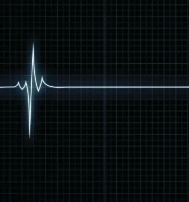  ??  ?? LEFT Absent of other factors, fatigue leads to sleep, which gives way to unconsciou­sness, until, eventually, the person dies