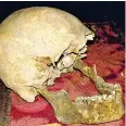  ??  ?? I resti
Il 23 gennaio scorso l’annuncio che il cranio conservato all’accademia di Arte Sanitaria a Roma apparterre­bbe a Plinio il Vecchio