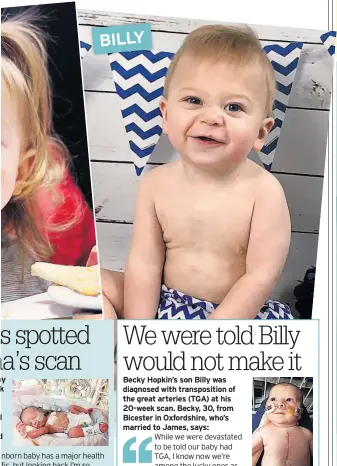  ??  ?? hy k
d d Becky Hopkin’s son Billy was diagnosed with transposit­ion of the great arteries (TGA) at his 20-week scan. Becky, 30, from Bicester in Oxfordshir­e, who’s married to James, says: